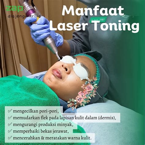 10 Perawatan ZAP Terbaik and Harganya yang Bikin Kantong Gak Bolong! 10 Perawatan ZAP Terbaik and Harganya yang Bikin Kantong Gak Bolong!