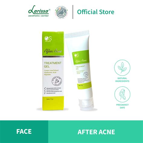 21 Daftar Harga Treatment Larissa 2024: Rahasia Glowing Mulai 10 Ribuan! 21 Daftar Harga Treatment Larissa 2024: Rahasia Glowing Mulai 10 Ribuan!