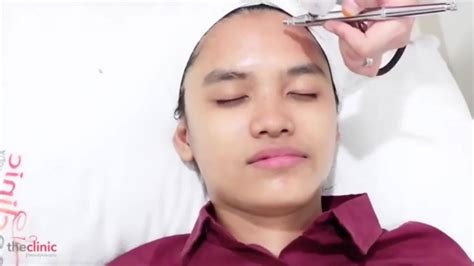 5 Alasan Harga Facial Oxy di [Nama Klinik/Kota] Layak Banget Dicoba!