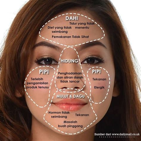 5 Cara Ampuh Hempaskan Jerawat di Dahi dalam 7 Hari! 5 Cara Ampuh Hempaskan Jerawat di Dahi dalam 7 Hari!