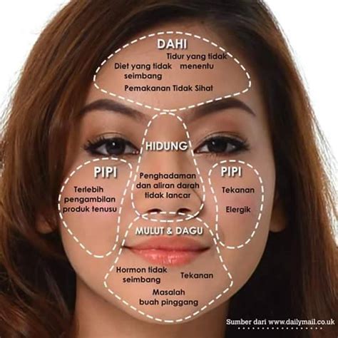 5 Cara Ampuh Hempaskan Jerawat di Dahi dalam 7 Hari! 5 Cara Ampuh Hempaskan Jerawat di Dahi dalam 7 Hari!