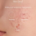 5 Cara Simpel Bikin Kulit Keringmu Lembap Bak Bayi!