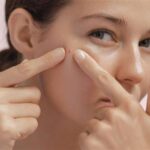 5 Rahasia Alami Bikin Jerawat Langsung Hilang (Bakal Gak Nambah Lagi!)