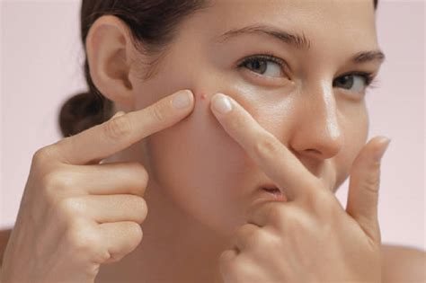 5 Rahasia Alami Bikin Jerawat Langsung Hilang (Bakal Gak Nambah Lagi!)