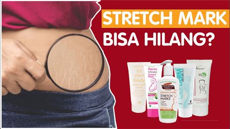 5 Rahasia Alami Hilangkan Stretch Mark Dalam 2 Minggu! 5 Rahasia Alami Hilangkan Stretch Mark Dalam 2 Minggu!