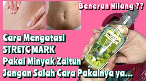 5 Rahasia Alami Hilangkan Stretch Mark Dalam 2 Minggu! 5 Rahasia Alami Hilangkan Stretch Mark Dalam 2 Minggu!