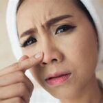5 Rahasia Ampuh Nampolkan Komedo Hitam di Hidung (Tanpa Sebor Pakai?)