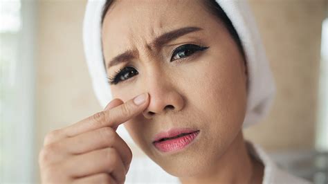 5 Rahasia Ampuh Nampolkan Komedo Hitam di Hidung (Tanpa Sebor Pakai?)