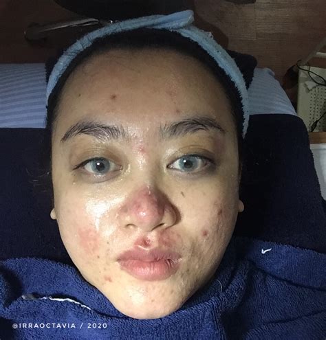 5 Rahasia Facial di NMW yang Bikin Wajah Glowing dalam Seminggu! 5 Rahasia Facial di NMW yang Bikin Wajah Glowing dalam Seminggu!