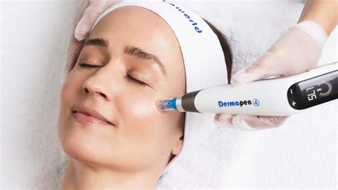 5 Rahasia Perawatan Wajah Dermapen Glowing Dalam 7 Hari! 5 Rahasia Perawatan Wajah Dermapen Glowing Dalam 7 Hari!