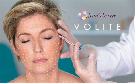 5 Skin Booster Terbaik yang Wajib Kamu Coba! 5 Skin Booster Terbaik yang Wajib Kamu Coba!