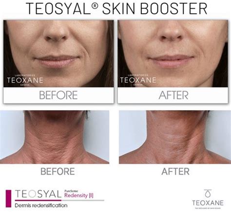 5 Skin Booster Terbaik yang Wajib Kamu Coba! 5 Skin Booster Terbaik yang Wajib Kamu Coba!