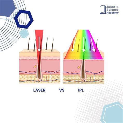5 Tarif Laser Wajah Paling Murah 2024: Wajah Glowing Mulai dari Rp99 Ribu! 5 Tarif Laser Wajah Paling Murah 2024: Wajah Glowing Mulai dari Rp99 Ribu!