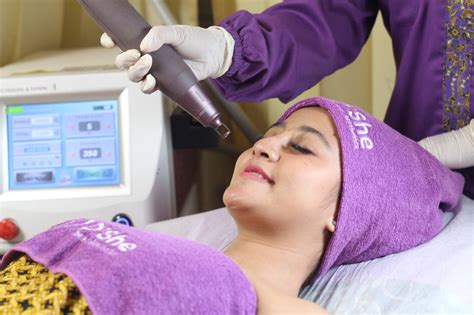 5 Tarif Laser Wajah Paling Murah 2024: Wajah Glowing Mulai dari Rp99 Ribu! 5 Tarif Laser Wajah Paling Murah 2024: Wajah Glowing Mulai dari Rp99 Ribu!