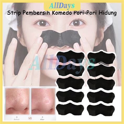 5 Treatment Hilangkan Komedo yang Bikin Kulit Kinclong dalam Seminggu! 5 Treatment Hilangkan Komedo yang Bikin Kulit Kinclong dalam Seminggu!