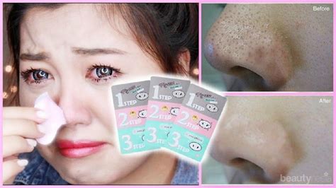 5 Treatment Hilangkan Komedo yang Bikin Kulit Kinclong dalam Seminggu! 5 Treatment Hilangkan Komedo yang Bikin Kulit Kinclong dalam Seminggu!