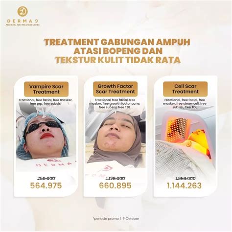 5 Treatment Wajah Bopeng Merawat Kulit Impian, Mulai Rp100.000! 😱