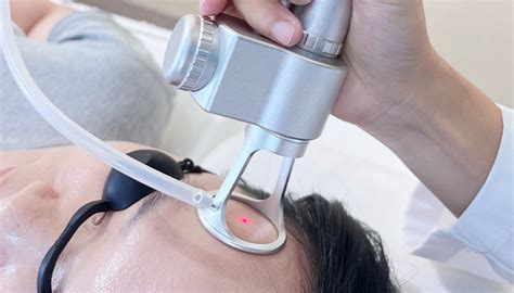 5 Varian Harga Laser Wajah MS Glow, Mana yang Cocok Buat Budgetmu? 5 Varian Harga Laser Wajah MS Glow, Mana yang Cocok Buat Budgetmu?