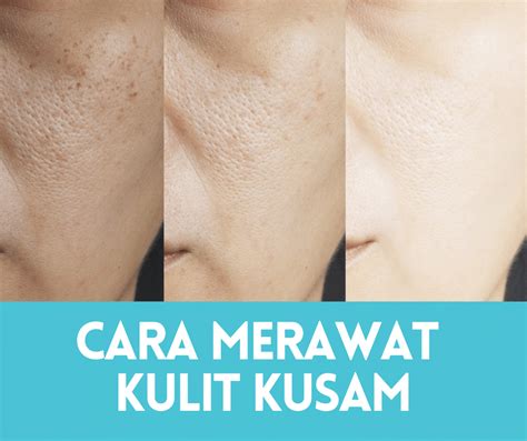 7 Cara Alami Agar Muka Tidak Kusam yang Bisa Kamu Terapkan Setiap Hari! 7 Cara Alami Agar Muka Tidak Kusam yang Bisa Kamu Terapkan Setiap Hari!