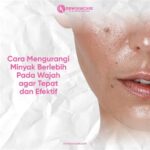 7 Cara Ampuh Menghilangkan Jerawat dan Minyak Berlebih pada Kulit dalam 1 Minggu!
