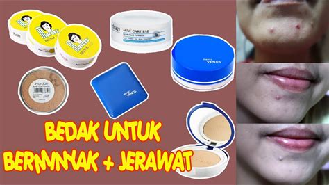 7 Cara Ampuh Menghilangkan Jerawat dan Minyak Berlebih pada Kulit dalam 1 Minggu! 7 Cara Ampuh Menghilangkan Jerawat dan Minyak Berlebih pada Kulit dalam 1 Minggu!