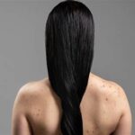 7 Cara Ampuh Perawatan Jerawat Punggung yang Bisa Kamu Lakukan di Rumah dengan Bahan Alami di Zap!