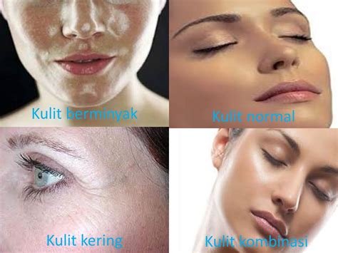 7 Cara Simple Mengatasi Kulit Berminyak dalam 10 Menit Sehari! 7 Cara Simple Mengatasi Kulit Berminyak dalam 10 Menit Sehari!