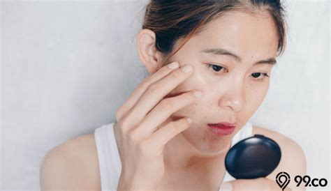 7 Cara Simple Mengatasi Kulit Berminyak dalam 10 Menit Sehari!