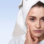 7 Langkah Skincare Anti Ribet Buat Remaja Kulit Sensitif and Berjerawat!
