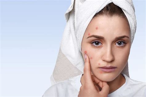 7 Langkah Skincare Anti Ribet Buat Remaja Kulit Sensitif and Berjerawat!