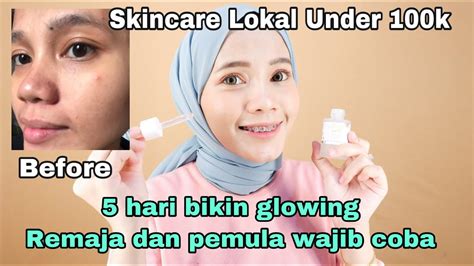 7 Rahasia Kulit Glowing Bebas Jerawat untuk Remaja: Buktikan Sendiri!