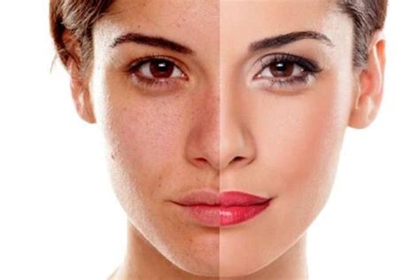 7 Rahasia Kulit Glowing Bebas Kusam and Minyak Berlebih! 7 Rahasia Kulit Glowing Bebas Kusam and Minyak Berlebih!