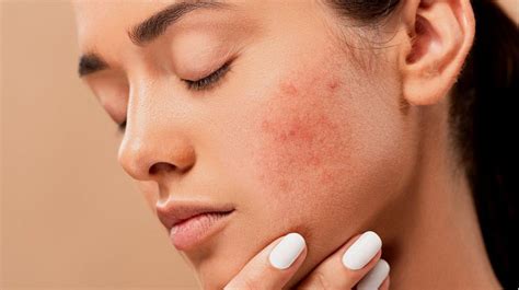 7 Rahasia Kulit Kering Jadi Glowing: Bye-Bye Kusam! 7 Rahasia Kulit Kering Jadi Glowing: Bye-Bye Kusam!