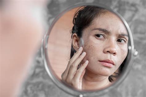 7 Rahasia Kulit Kering Jadi Glowing: Bye-Bye Kusam!