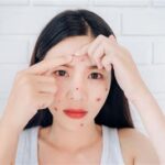 7 Rahasia Perawatan Wajah Breakout yang Terbukti Ampuh!