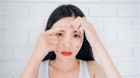 7 Rahasia Perawatan Wajah Breakout yang Terbukti Ampuh!