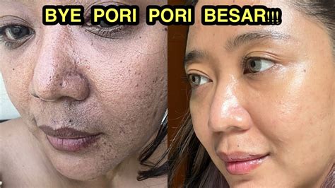 7 Rahasia Perawatan Wajah Harian untuk Mengecilkan Pori-Pori dalam 14 Hari! 7 Rahasia Perawatan Wajah Harian untuk Mengecilkan Pori-Pori dalam 14 Hari!