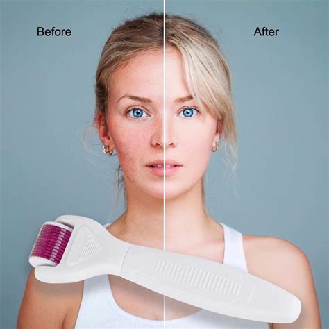 7 Rahasia Skincare Setelah Dermaroller Biar Wajah Kinclong Maksimal! 7 Rahasia Skincare Setelah Dermaroller Biar Wajah Kinclong Maksimal!