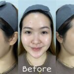 7 Treatment Dermies di Bawah 500 Ribu: Bye-Bye Kusam, Halo Glowing!