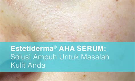 7 Treatment Estetiderma di Bawah 500 Ribu! Rahasia Glowing Tanpa Bokek? 7 Treatment Estetiderma di Bawah 500 Ribu! Rahasia Glowing Tanpa Bokek?