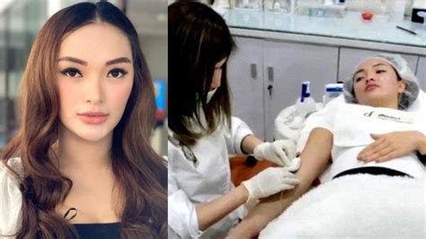 Rahasia Glowing Terungkap! Harga Perawatan di Clarice Beauty Clinic Mulai 79 Ribu Aja!