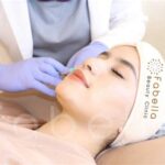 5 Laser Wajah Harga Bikin Kantong Gembira!