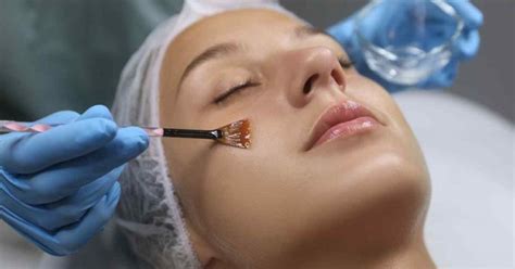 5 Peel-ing Wajah Murah Meriah Bikin Kulit Glowing! ✨