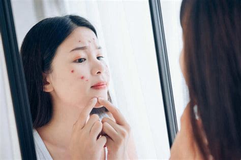 5 Skincare Mistakes Kamu Mungkin Lakukan Setiap Hari! 😱