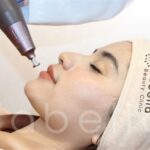 7 Treatment Ampuh Basmi Komedo Membandel, Nomor 5 Bikin Kaget!
