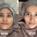 7 Treatment Facial Terlaris di ERHA and Harganya di 2024! Nomor 5 Bikin Kaget!