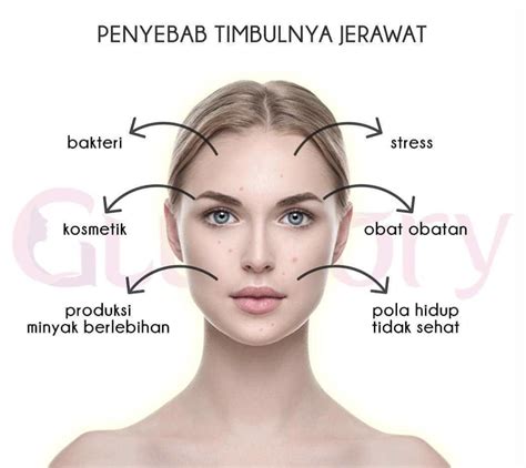 5 Cara Jitu Merawat Wajah Berjerawat dan Berminyak: Kulit Glowing Bebas Kilap! 5 Cara Jitu Merawat Wajah Berjerawat dan Berminyak: Kulit Glowing Bebas Kilap!