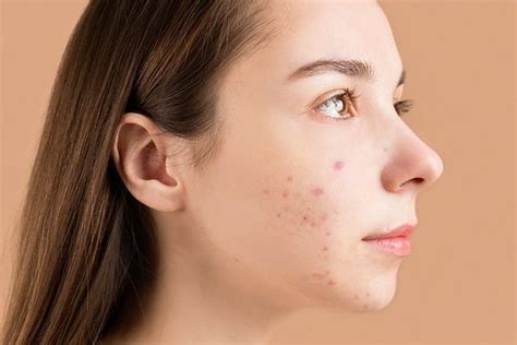 5 Cara Merawat Kulit Glowing Alami, Hasilnya Bikin Pangling! 5 Cara Merawat Kulit Glowing Alami, Hasilnya Bikin Pangling!