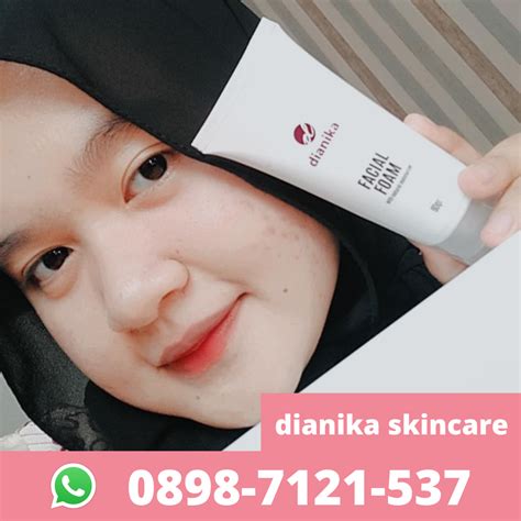 5 Harga Perawatan NMW Paling Dicari: Mulai dari Rp 99 Ribu! 5 Harga Perawatan NMW Paling Dicari: Mulai dari Rp 99 Ribu!