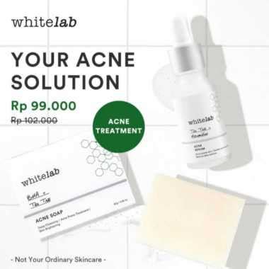 5 Paket Whitelab Murah Meriah di Bawah Rp100 Ribu, Kulit Cerah Berkaan Penuh! 5 Paket Whitelab Murah Meriah di Bawah Rp100 Ribu, Kulit Cerah Berkaan Penuh!